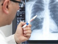 Пневмониядан науқастардың 80 пайызы жазылып шықты