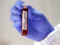 Қазақстанның 12 өңірінде 78 адамнан коронавирус анықталды